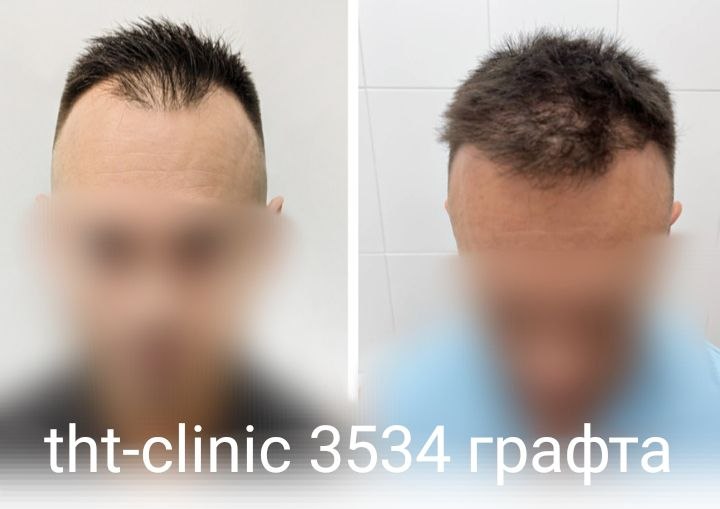 Результат процедуры 9