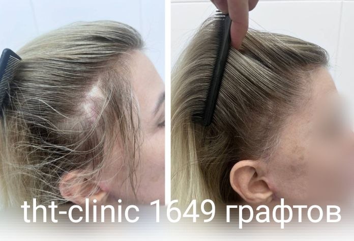 Результат процедуры 16