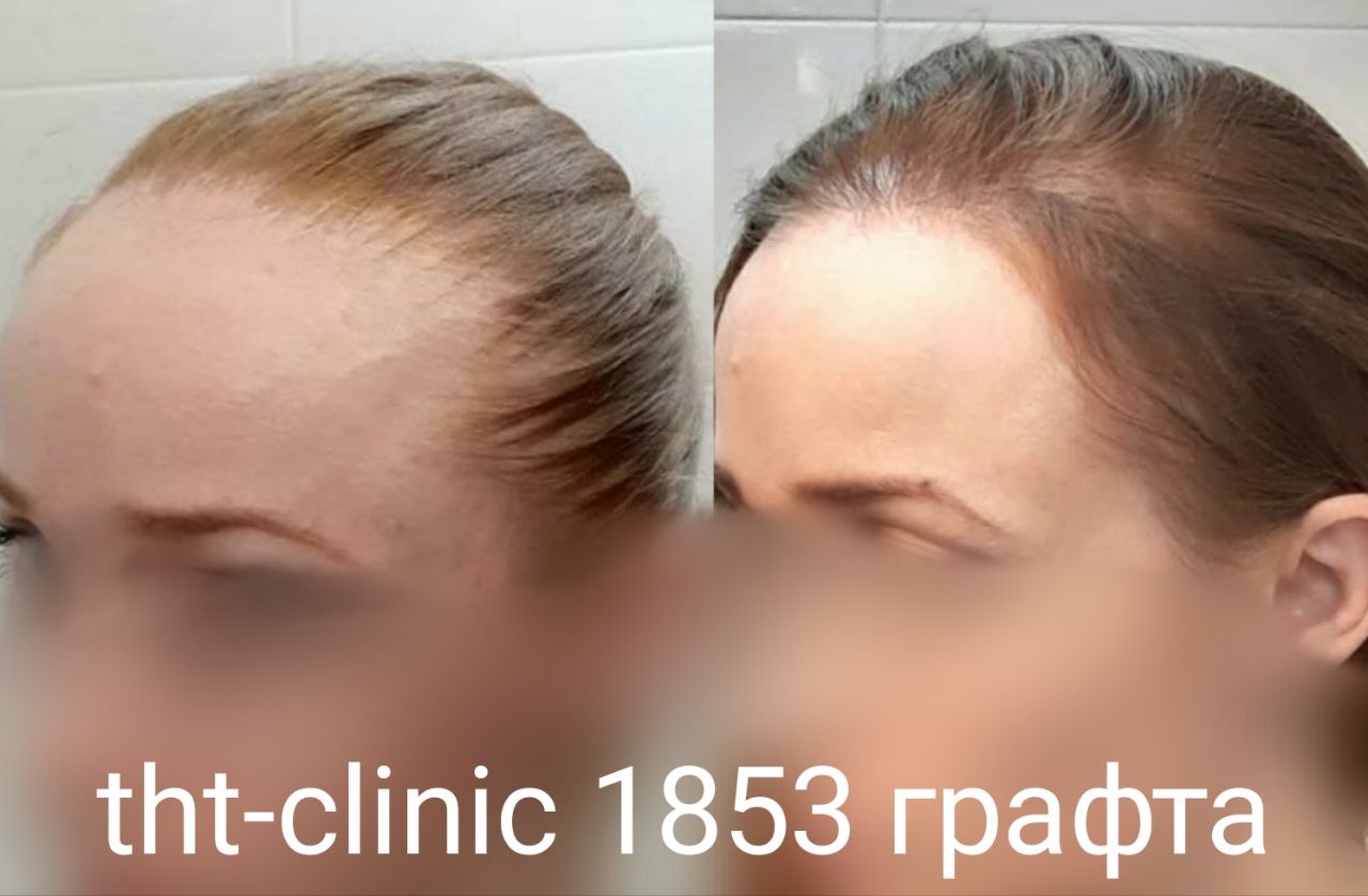 Результат процедуры 20
