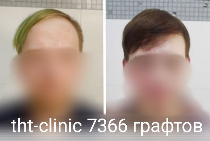Результат процедуры 26
