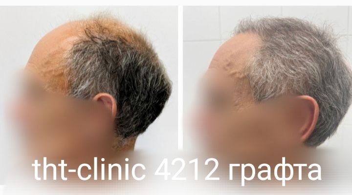 Результат процедуры 29